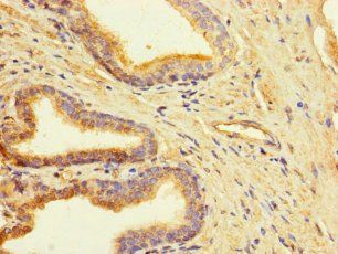 CLUAP1 Antibody