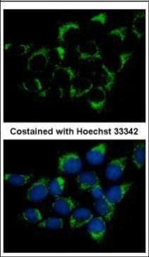 CMG1 antibody [C3], C-term