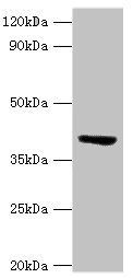 CMP-N-acetylneuraminate-beta-1, 4-galactoside alpha-2, 3-sialyltransferase antibody