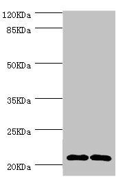 CMPK1 Antibody