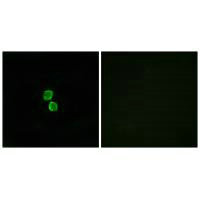 CMTM1 Antibody