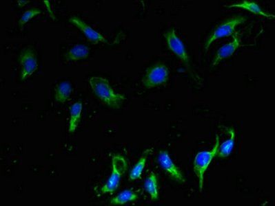 CMTM2 antibody