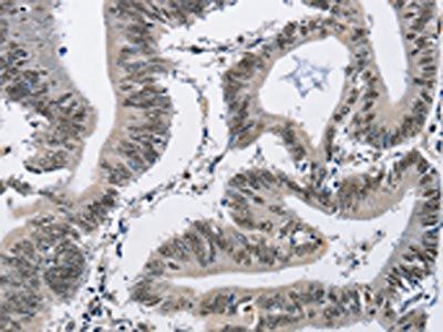 CMTM2 Antibody