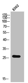 CMTM2 antibody