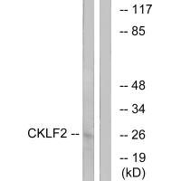 CMTM2 antibody