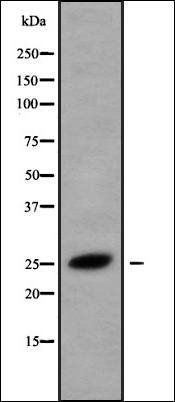 CMTM5 antibody