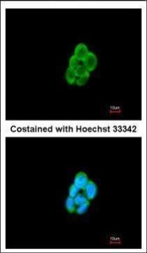 CMTM6 antibody