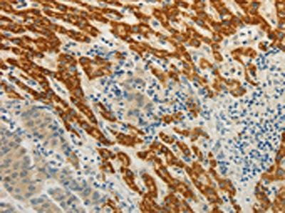 CMTM7 Antibody