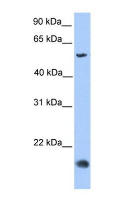 CMTM8 antibody