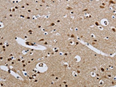 CMTM8 Antibody