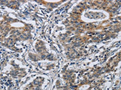 CMTM8 Antibody
