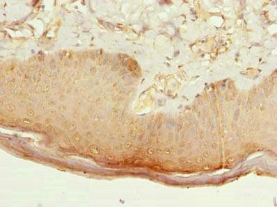 CMTR2 Antibody
