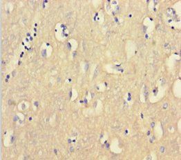 CNBP Antibody