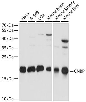 CNBP antibody