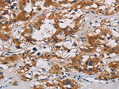CNDP1 Antibody