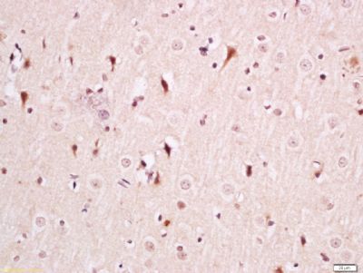 CNG3 Rabbit Polyclonal Antibody