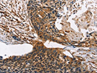 CNGA1 Antibody