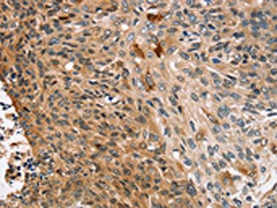 CNGA1 Antibody