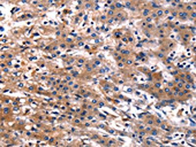 CNGA2 antibody