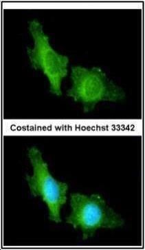 CNGA2 antibody [C1C3]