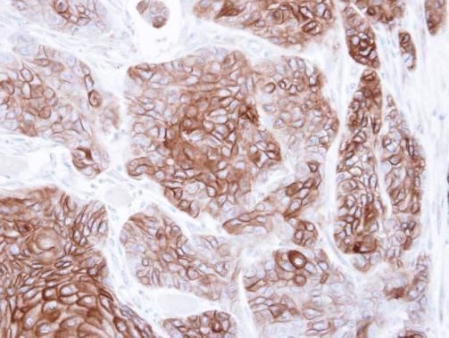 CNGA2 Rabbit Polyclonal Antibody