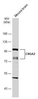CNGA2 Rabbit Polyclonal Antibody