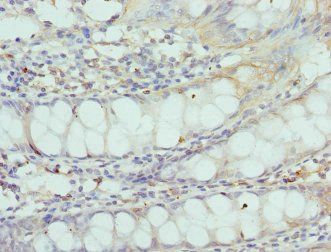 CNGA3 Antibody
