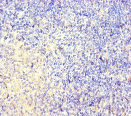 CNGA4 Antibody