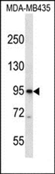 CNGB3 antibody