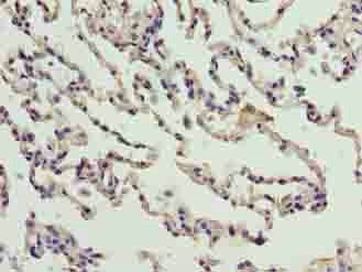CNIH3 antibody