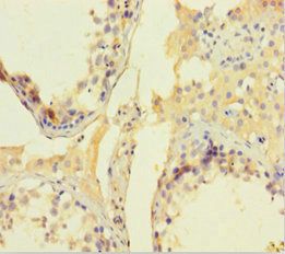 CNKSR2 Antibody