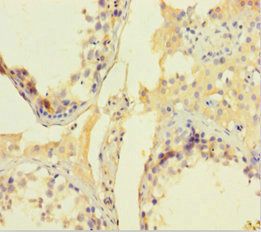 CNKSR2 antibody