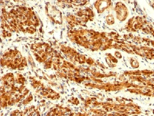 CNN1 Antibody