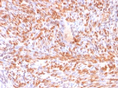 Recombinant Calponin-1 (Smooth Muscle Marker) Antibody
