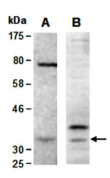 CNN1 (N) Antibody, Rabbit Polyclonal
