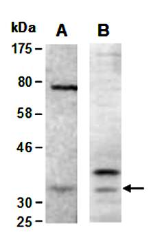 CNN1 antibody