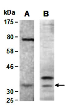CNN1 (C) Antibody, Rabbit Polyclonal