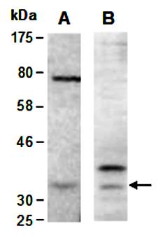 CNN1 antibody pair