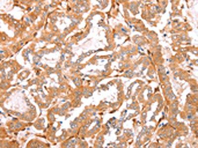 CNN3 Antibody