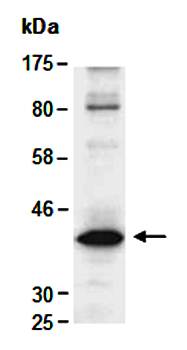 CNN3 (C) Antibody, Rabbit Polyclonal