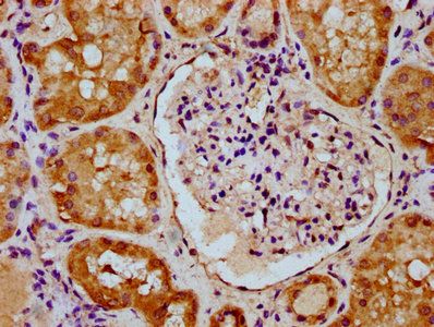 CNNM2 Antibody
