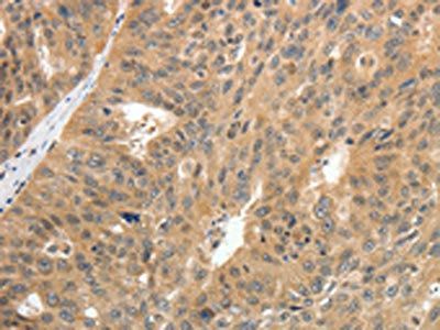 CNNM3 Antibody