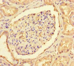 CNOT1 antibody