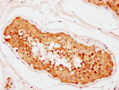 CNOT10 Antibody
