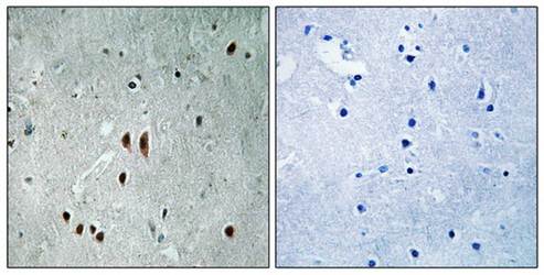 CNOT2 (Phospho-Ser101) Antibody