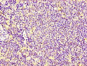 CNOT3 Antibody