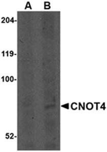CNOT4 Antibody