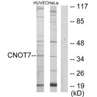 CNOT7 antibody