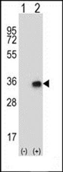 CNOT8 antibody