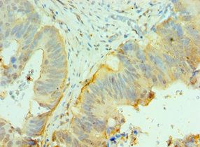 CNOT8 Antibody